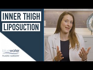 Liposuction Inner Thigh Results | Liposuction 360 Raleigh North Carolina | Blue Water Spa