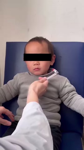 A 2-year-old boy was brought to the ED after he had had four generalized seizures in the previous week. Physical examination was notable for brisk tendon reflexes and Chvostek’s sign (shown in a video). Link to full case details in comments. | The New England Journal of Medicine