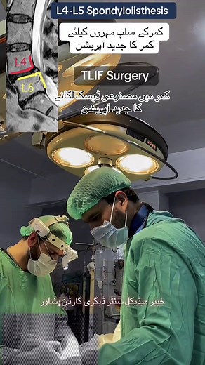 Comprehensive Guide to TLIF Surgery for Back Pain Relief