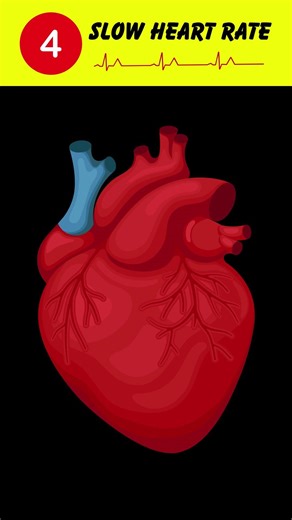 Five Most Common Side Effects Of Propofol
