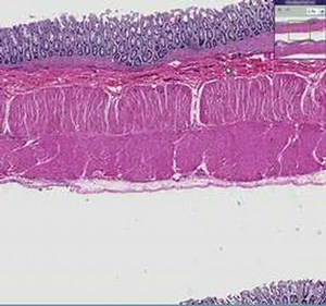 Histopathology Colon--Hirschsprung disease