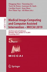 Real-Time 3D Reconstruction of Colonoscopic Surfaces for Determining Missing Regions | Medical Image Computing and Computer Assisted Intervention – MICCAI 2019