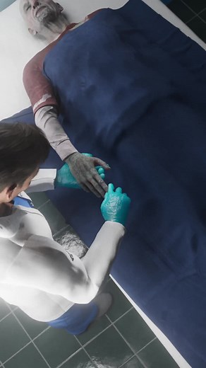 How Are Fingerprints Recovered From A Corpse 😮 | Fingerprint Technician
