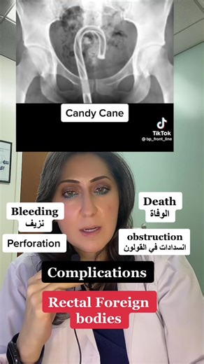 اشياء غريبة في المستقيم #forign #body #rectum #المستقيم #انتبهوا #انتبه #dr_majidah_bukhari #انتبه_لنفسك