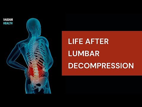 Life After Lumbar Decompression