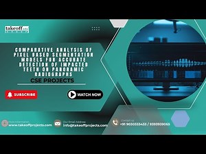 Impacted Teeth Detection Using Pixel-Based Segmentation | AI Models Comparison on Panoramic X-rays