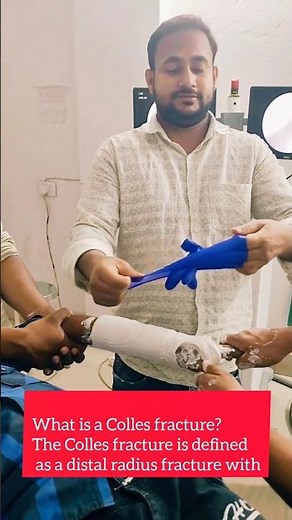 The Colles fracture is defined as a distal radius fracture with #viralvideo #hospital wrist fracture