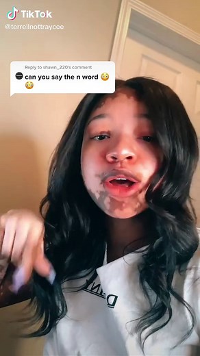 Reply to @shawn_220 PSA for all the slow ones out there 🚨 #vitiligo #fyp