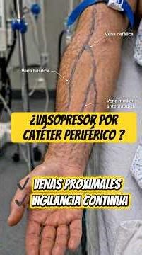 Norepinephrine via a peripheral vein? Yes, and it can be safe. #nursing