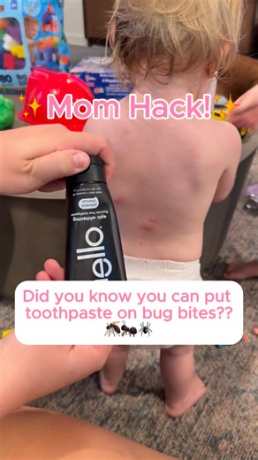 234K views · 490 reactions | Try this hack to help relieve those awful bug bites! #momhacks #parenthacks #toddlermom #toddlerlife #bugbites | Bre and Kyle | Facebook