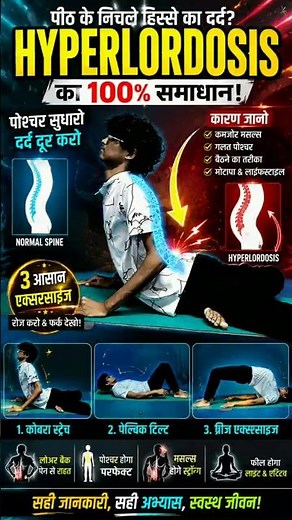 Hyperlordosis Fix | Naturally#Hyperlordosis #Lordosis #BackPain #LowerBackPain #PostureCorrection