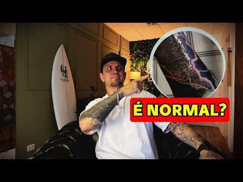 CICATRIZAÇÃO DE TATUAGEM: O QUE É NORMAL E O QUE NÃO É!
