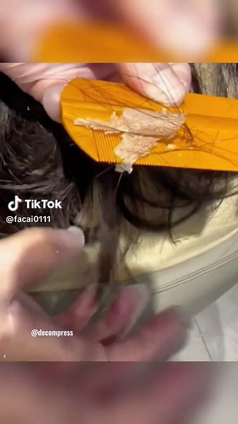 Effective Solutions for Scalp Scab Problems