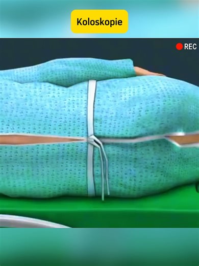 Medizinischer 3D-Druck: Revolution in der Gesundheitsversorgung