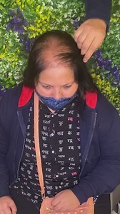 Human Hair Toppers For Volume & DensitySWIPE to see 10 Amazing...