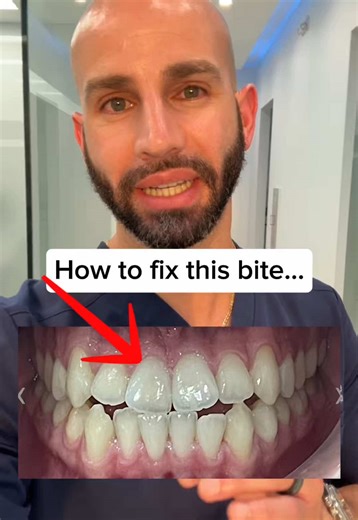 Understanding Underbites and Their Treatment Options