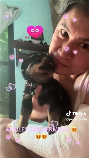 LONG ARM CAST WOMAN #yeso #brazo #cast