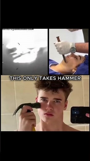 No surgeries #glowuptips #explore #glowlook #jawline #jawlinegoals #male #glowups #clearskin