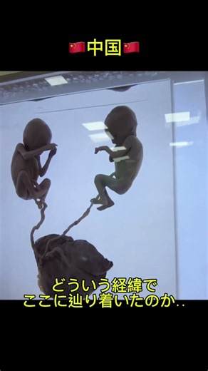 🇨🇳中国には人体の不思議展が常設された博物館がある。出どころは不明の為、日本ではもう展示されない。 #海外旅行 #museum #中国旅行 #博物館 #海外一人旅 #人体の不思議
