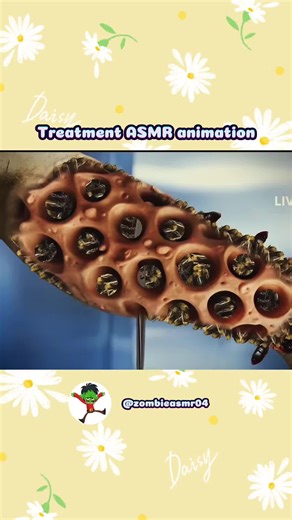 Treatment legs ASMR - Part 3 #asmr #asmrvideos #asmrtiktok #relaxing #satisfyingsounds