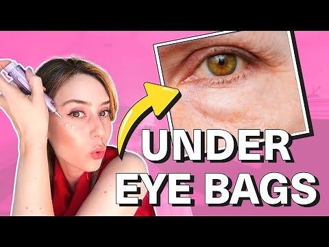 How To Get Rid Of Under Eye Bags & Puffy Eyes! | Dr. Shereene Idriss