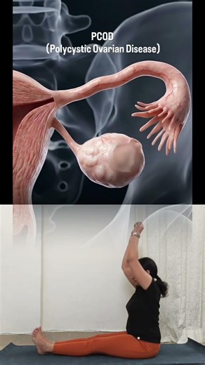 Struggling with PCOD/PCOS? 🥺✨ Try these 3 super easy yoga poses #pcos #pcod #periods