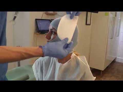 First Stage-p1 of MewVector Orthodontic Orthotropics Headgear (Head Brace) Preparation- Dr Mike Mew
