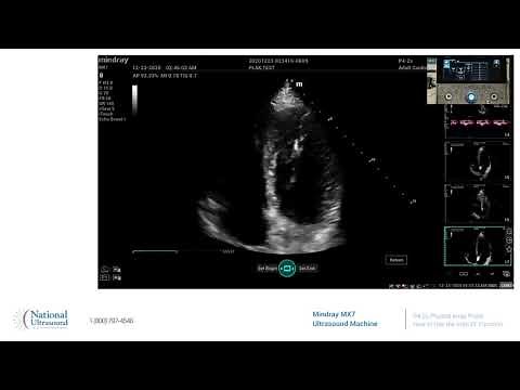 How to Use the Auto EF Function on the Mindray MX7 Ultrasound Machine