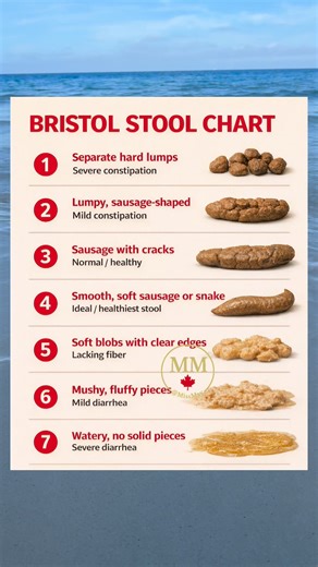 159K views · 48 reactions | Your poop says a lot about your gut health  #GutHealth #HealthAwareness #guthealthforlife #healthtips | Miss May | Facebook