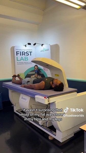 Resultados del DEXA: Revelando mi porcentaje de grasa corporal