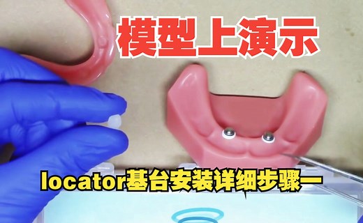 模型演示种植牙修复的locator桥架戴牙的详细过程