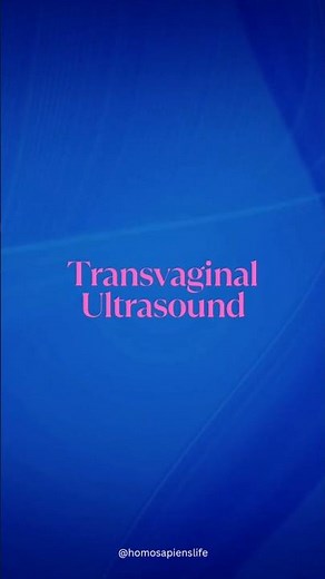Transvaginal Ultrasound | Gynecology | #ultrasound #gynecology #obstetrics