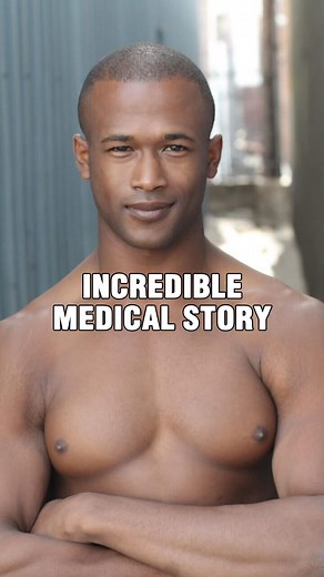 Doctor Ricky | Plastic Surgeon on Instagram: "My most emotional case so far in 13 years of practice. … #gynecomastia #menshealth #male #man #reduction #help #give #giving #givingback #brownsanatomy #story #medicalstory #bully #bullying #stopbullying"