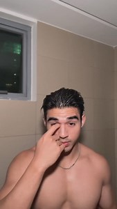20K views · 2.5K reactions | sharing my hack for acne scar prevention pt. 1 | Antonio Stevens’ Universe | Facebook
