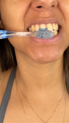 Whiten your teeth with this powerful mixture in just two minutes! 🦷 😱 | Top Tips
