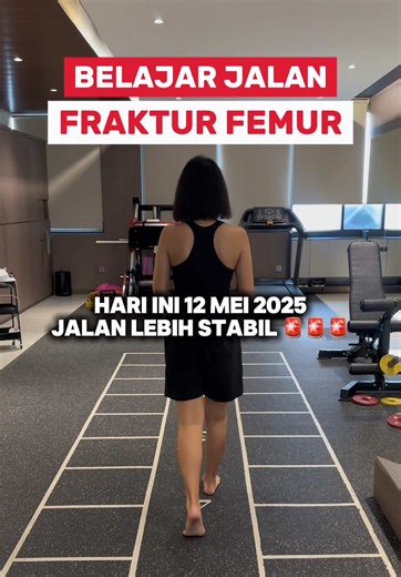 Fraktur Femur: Proses Pemulihan Pasien dari Singapore