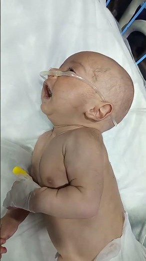 "High Bilirubin Complication 👶 | Kernicterus Case Under Care" #neonatologist #newbornbaby #cutebaby