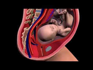 Chorioamnionitis Explained by a Lawyer