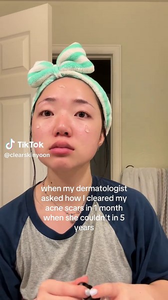 Clear Acne Scars in 1 Month | Dermatologist Shocked!