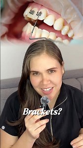 Braces check-up #shortvideo #braces #dentist #dentalprosthesis #orthodontics #viral #greenscreen