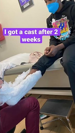 My broken foot journey