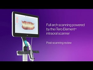 Full arch scanning powered by the iTero Element™ intraoral scanner | post-scanning review