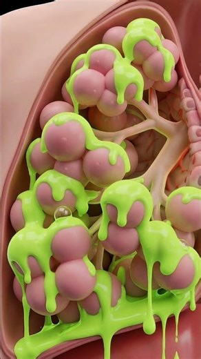 What Vaping REALLY Does To Your Lungs 🫁