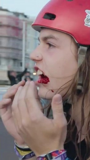 WHEN THE BIKE BITES BACK!