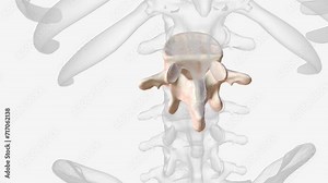 The L2 vertebra is the second uppermost of the five (5) lumbar vertebrae toward the lower end of the spinal column, within the lower back.