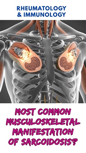 INI SS – DM Rheumatology & Immunology | SPEED Learning App 📲 Scan & Register | Limited Seats! Click here for Registration https://www.speedlearningapp.com/ For assistance call 📱 Mobile: 9840077508 📘 Premium Course Join India’s top-tier Rheumatology SS training program. Expert mentors | Online Live Recorded Lectures | 15 Mock Tests | 15,000 High-Yield MCQs 🎯 INI SS 2025 Enroll now & start early for the best results! | SPEED Medical Centre