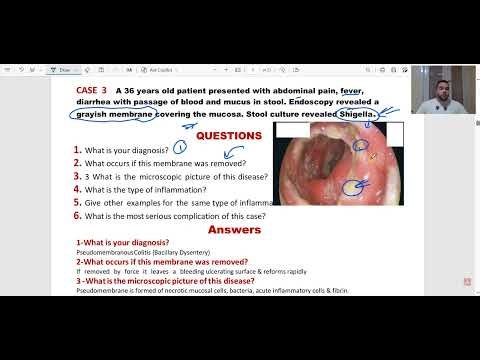 شرح Cases of General pathology