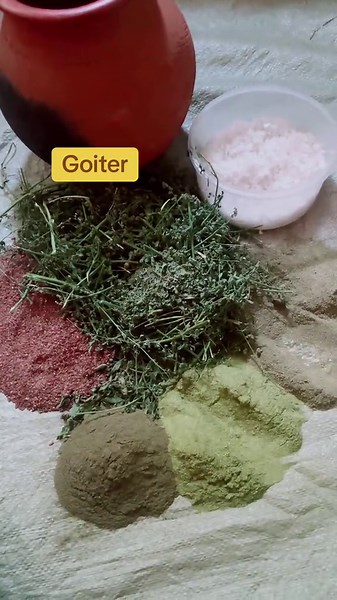 Natural Medicine Remedies for Goiter Relief