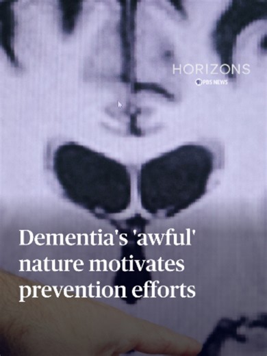 What motivates patients to mitigate risk factors for dementia? Dr. Jonathan Rosand, the founder of the Global Brain Care Coalition, says that for those who have watched someone they care about live with dementia, it's a