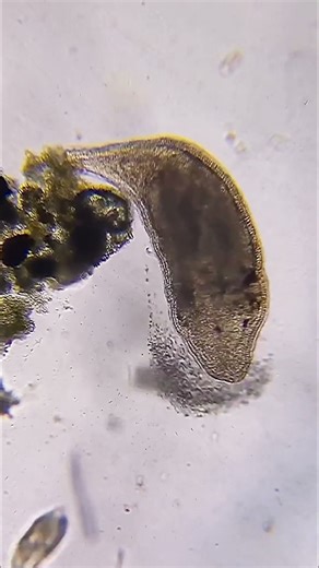 Through the Invisible #microorganisms #microscopyworld #scienceandart